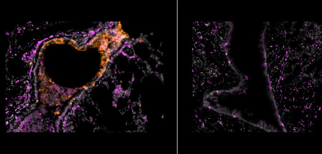Mit Nanobodies gegen Covid-19