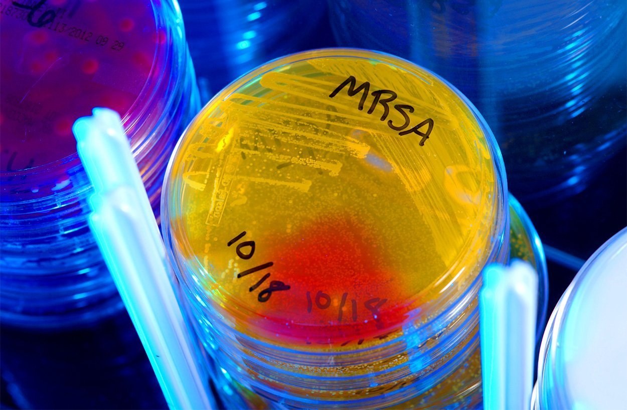 Neue Antibiotika gegen MRSA
