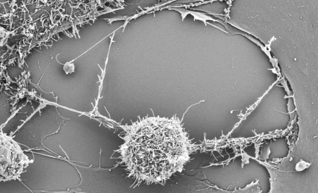 Immunzellen „Zusatz-Batterien“ verschafft