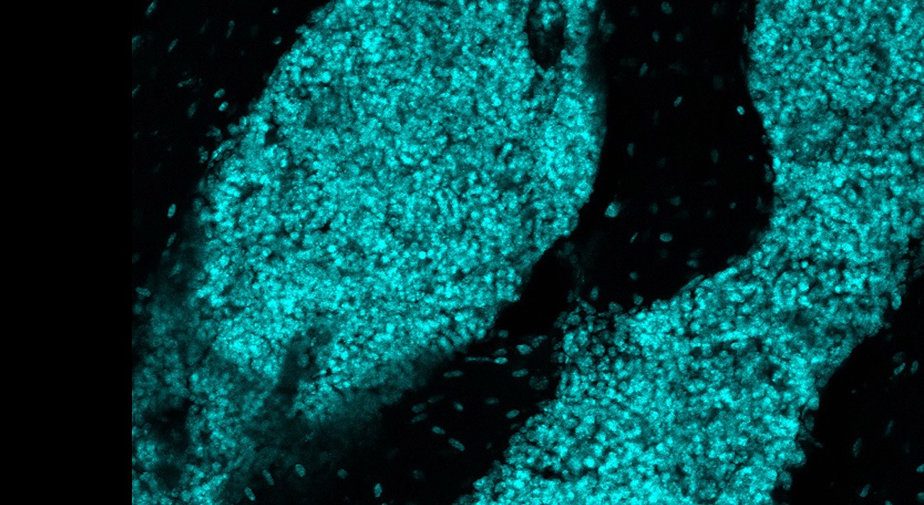 Neuartige Immunstruktur im Schädelknochen entdeckt