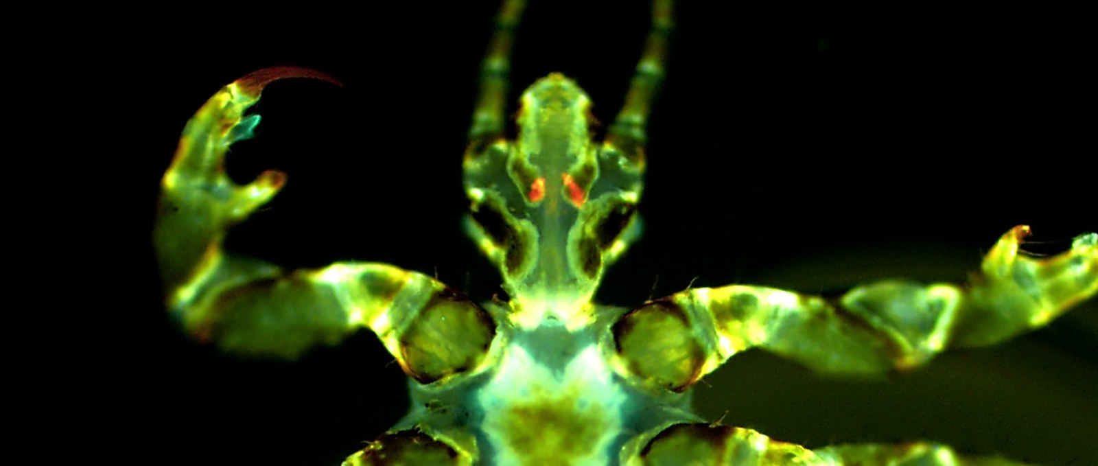 Körperläuse als effektive Pest-Überträger