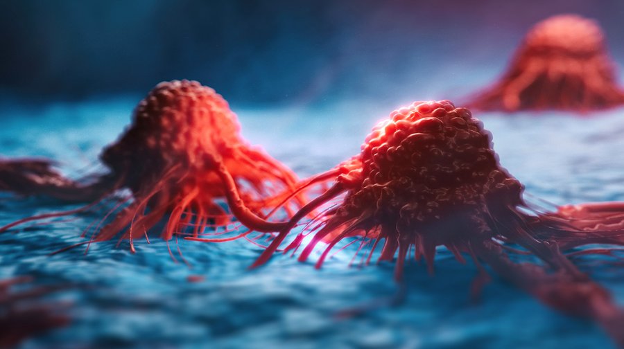 „Zombiezellen”: Warum Krebs nach der Chemotherapie oft wiederkommt